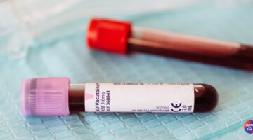 22 Interesting Facts About Human Blood