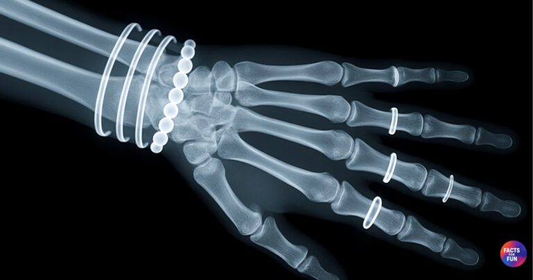 Facts About Bones Stronger Than Steel